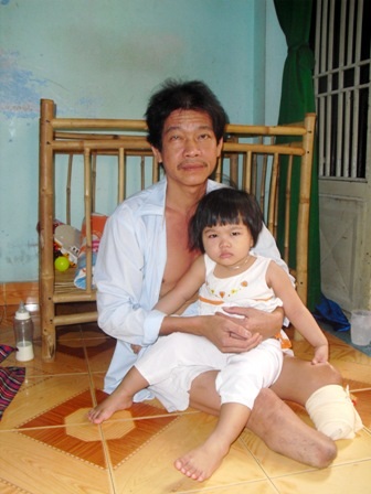 Anh Vinh chỉ mong được lắp chân giả để đi lại bình thường và giúp vợ chăm con
