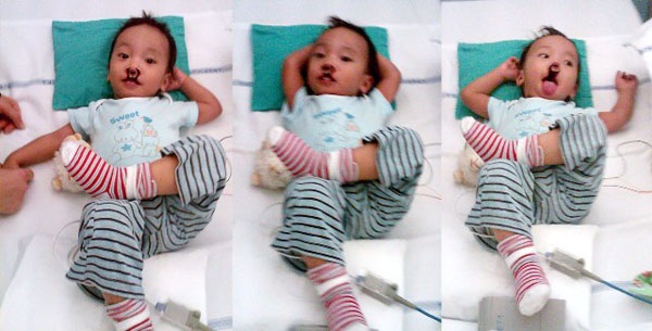 Ngắm ảnh Nhân Nghĩa sau ca đại phẫu