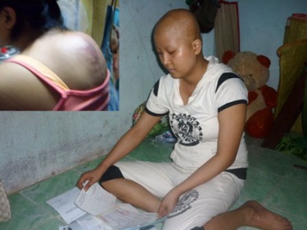 Thu Thủy của 3 năm trước tiều tụy vì bệnh ung thư