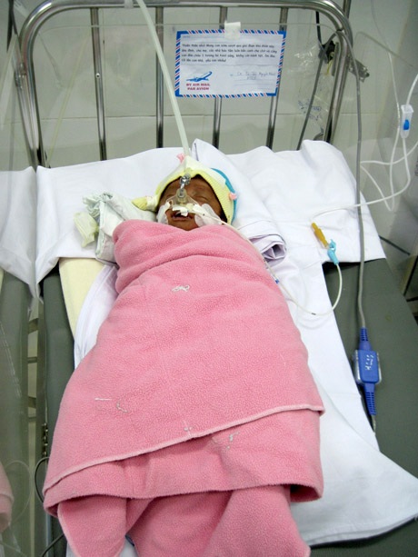 Bé sinh non thoi thóp thở và chiếc phong thư bí ẩn