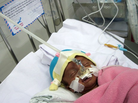 Bé sinh non thoi thóp thở và chiếc phong thư bí ẩn