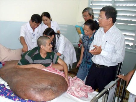 Khối bướu khổng lồ của anh Hải từng gây sự chú ý đặc biệt của cả thế giới - Ảnh: Vân Sơn