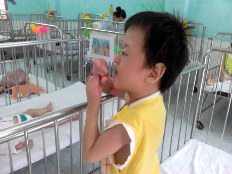 Em Nghĩa với các ngón tay, ngón chân bị dính đang chờ phẫu thuật tách ngón  