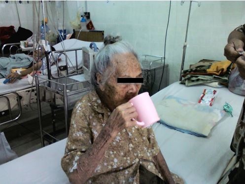 Bệnh nhân T.S. sau khi được đặt máy tạo nhịp tim vĩnh viễn (ảnh: BV Cấp cứu Trưng Vương)