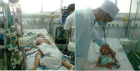 Cứu sống trẻ suy đa cơ quan do sốt xuất huyết - 1 Cháu C.được thở máy và lọc máu liên tục và đã bình phục sau 1 tuần (Ảnh: BV Nhi Đồng 1 TPHCM)