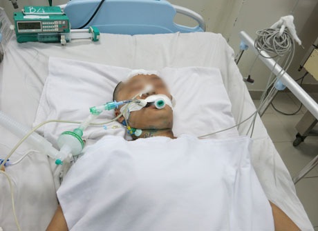 Bệnh nhân N.T.H.N. đang được điều trị tại khoa Gây mê hồi sức, bệnh viện 115