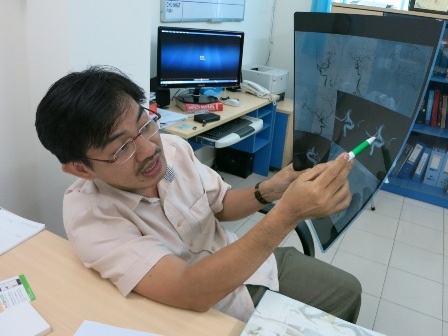 TS-BS Nguyễn Huy Thắng chia sẻ về phương pháp can thiệp nội mạch để cấp cứu đột quỵ