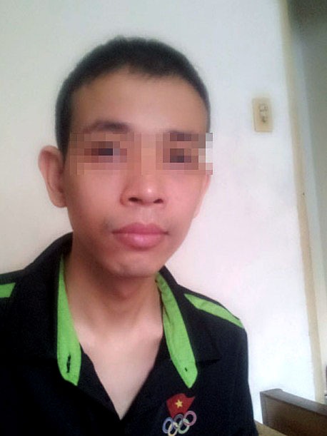 Chữa trĩ 5 năm mới phát hiện ung thư trực tràng giai đoạn muộn - 1 Bệnh nhân N.H.H. còn quá trẻ nên các bác sĩ không nghĩ đến khả năng anh bị ung thư trực tràng