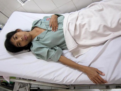 Anh mất vì tai nạn giao thông, em nguy kịch vì bệnh suy thận - 1 Ngọc Băng ở tuổi 26 mà cân nặng của em chỉ bằng một đứa trẻ lên 10