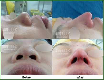 Nâng mũi Hàn Quốc công nghệ Tutoplast & Megaderm - 9 Đội ngũ nhân viên chuyên nghiệp tại Thẩm mỹ Hàn Quốc