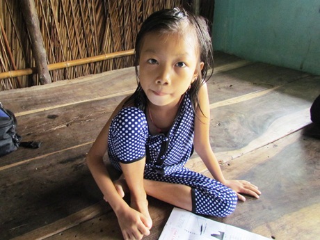 Bé Nguyễn Thị Kiều dù đã 7 tuổi, nhưng dáng người nhỏ bé, xanh xao cân nặng chỉ chưa đầy 13 kg