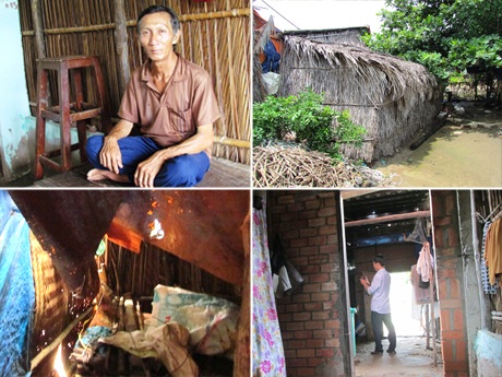 Bệnh thalassemia (thiếu máu) khiến bé Kiều phải thường xuyên vào viện truyền máu