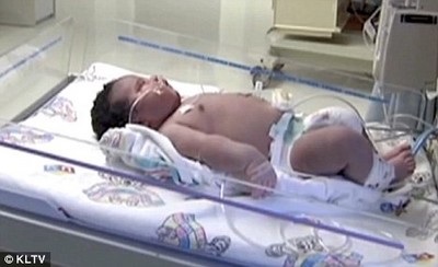 Bé sơ sinh "khổng lồ" nặng gần 7,3kg chào đời tại Mỹ - 1 Bé sơ sinh "khổng lồ" nặng gần 7,3kg chào đời tại Mỹ - 1