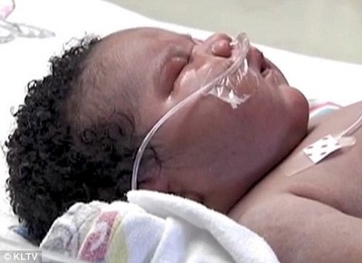 Bé sơ sinh "khổng lồ" nặng gần 7,3kg chào đời tại Mỹ - 2 Bé sơ sinh "khổng lồ" nặng gần 7,3kg chào đời tại Mỹ - 2