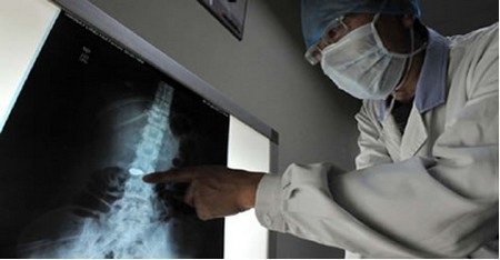 Nuốt cả sợi dây chuyền vào bụng - 1 Nuốt cả sợi dây chuyền vào bụng - 1