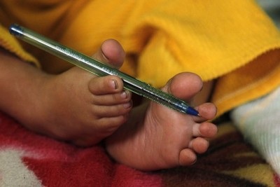 Cậu bé không tay tại Peru - 10