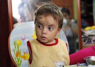 Cậu bé không tay tại Peru - 6