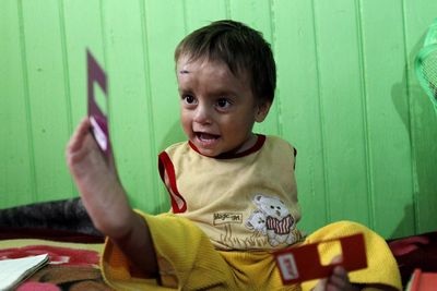 Cậu bé không tay tại Peru - 7