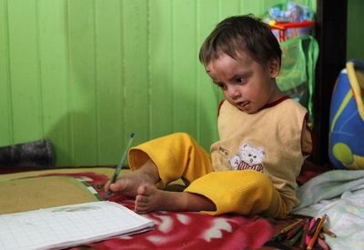 Cậu bé không tay tại Peru - 8