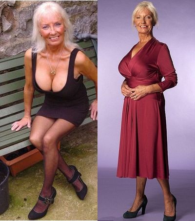 Cụ bà 65 tuổi bơm ngực để hạnh phúc hơn - 1 Cụ bà 65 tuổi bơm ngực để hạnh phúc hơn - 1