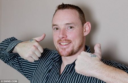 Dùng ngón chân cái để “thế” ngón tay cái - 4 Dùng ngón chân cái để “thế” ngón tay cái - 4