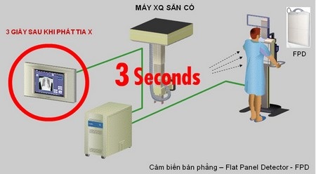Giải pháp số giúp nâng cao chất lượng chẩn đoán hình ảnh X-Quang - 1 Mô tả nguyên lý hoạt động của hệ thống DROC