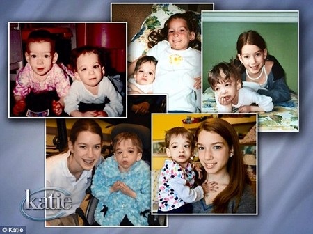 Em gái Carly của Brooke vẫn phát triển bình thường