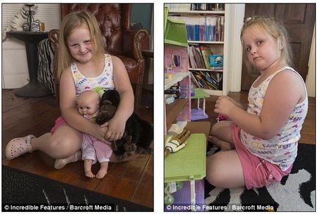 Gia đình McKean hy vọng sự tiến bộ của y học sẽ giúp chữa được cho căn bệnh của cô bé