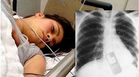 Thiếu nữ nuốt điện thoại vào bụng vì sợ bạn trai đọc được tin nhắn - 1 Adriana Andrade tại bệnh viện và chiếc điện thoại trong bụng của cô