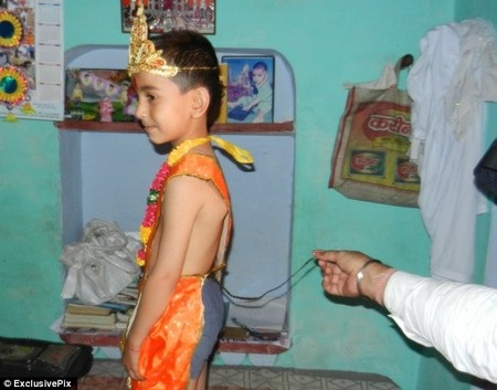 Bé Amar vẫn phát triển bình thường như những đứa trẻ khác