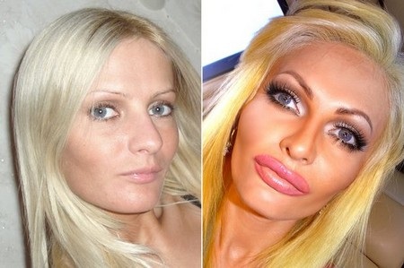 Cô gái chi hơn 30.000 bảng Anh để biến thành “búp bê người lớn” - 2 Gương mặt của Victoria đã biến đổi hoàn toàn sau khi có sự can thiệp của dao kéo