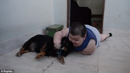 Bé trai 3 tuổi nặng 70 kg - 2 Cơ thể quá nặng khiến cậu bé Misael gặp nhiều khó khăn trong việc đứng và đi lại