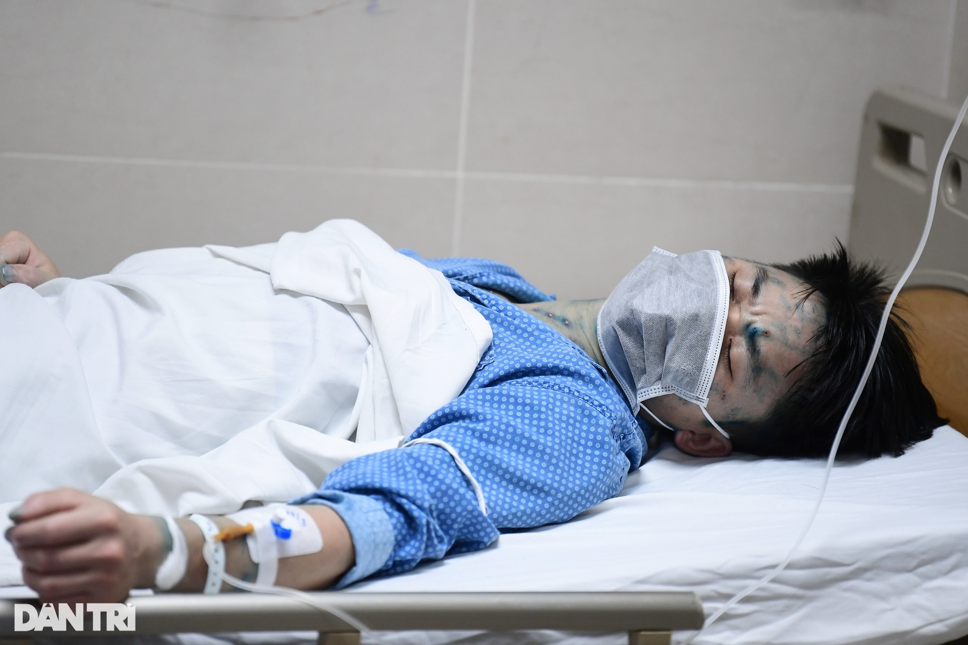 Hà Nội: Nhiều người nổi mụn nước chi chít phải nhập viện vì dịch bất thường - 12 Hà Nội: Nhiều người nổi mụn nước chi chít phải nhập viện vì dịch bất thường - 12