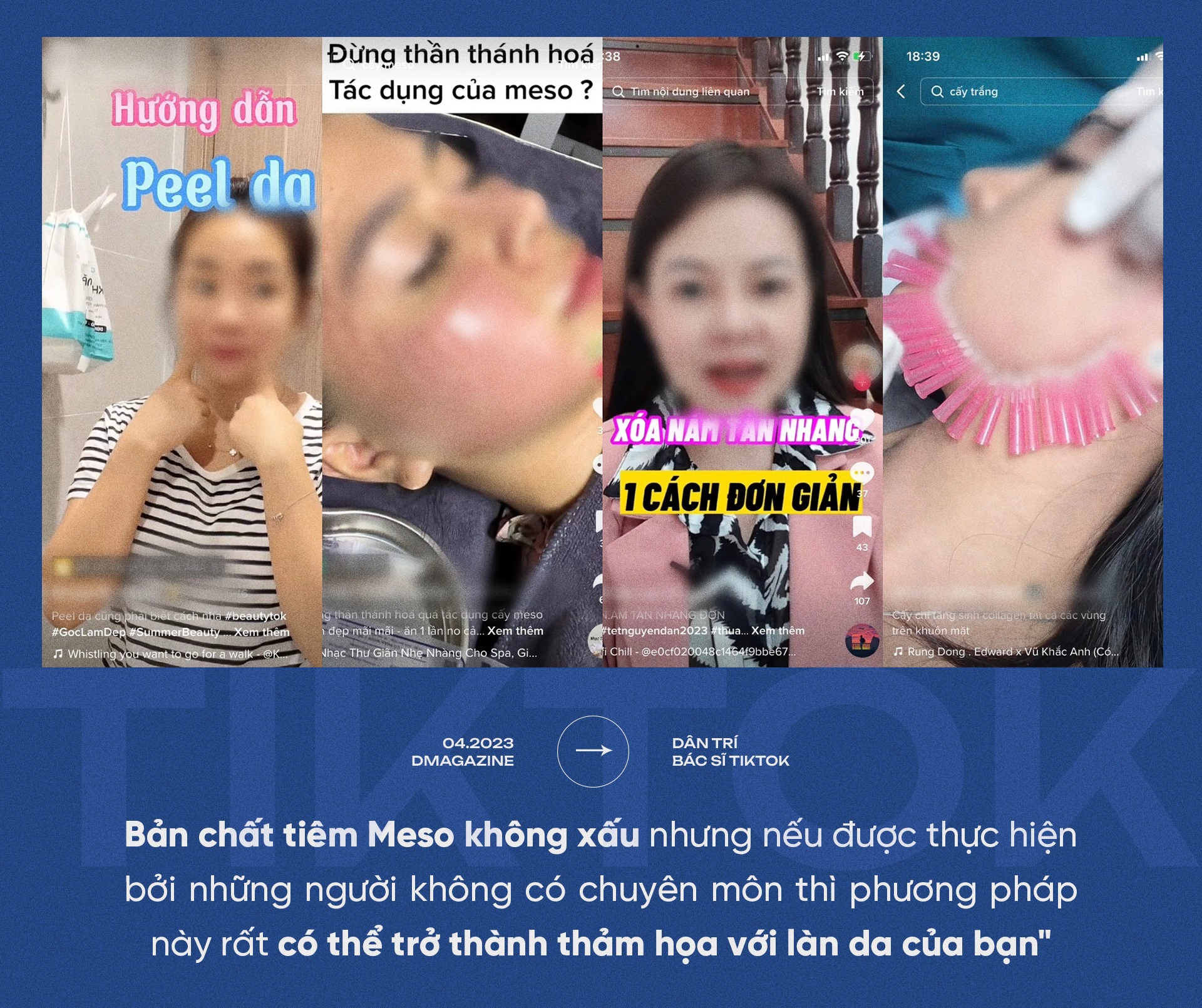 Nát mũi, hỏng mặt, biến chứng thai kỳ vì bác sĩ Tiktok - 19 Nát mũi, hỏng mặt, biến chứng thai kỳ vì bác sĩ Tiktok - 19