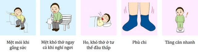 Suy tim - chặng đường cuối nhọc nhằn của các bệnh tim mạch - 2 Các dấu hiệu điển hình của suy tim