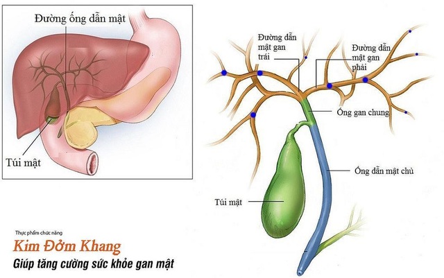 Bị sỏi mật trong gan, tránh chủ quan nếu không muốn phải mổ gan lấy sỏi - 2 Sỏi gan có thể gây ra nhiều biến chứng nguy hiểm