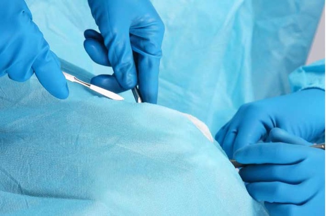 Thoát vị bẹn: cần phẫu thuật sớm tránh “chuyện bé xé ra to”! - 2 Có hai phương pháp khác nhau được áp dụng trong phẫu thuật thoát vị bẹn là nội soi và mổ hở.