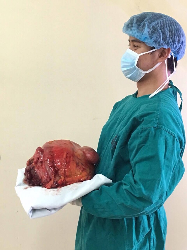 Cụ ông mang khối u cứng như đá nặng hơn 10kg trong bụng - 1 Cụ ông mang khối u cứng như đá nặng hơn 10kg trong bụng - 1