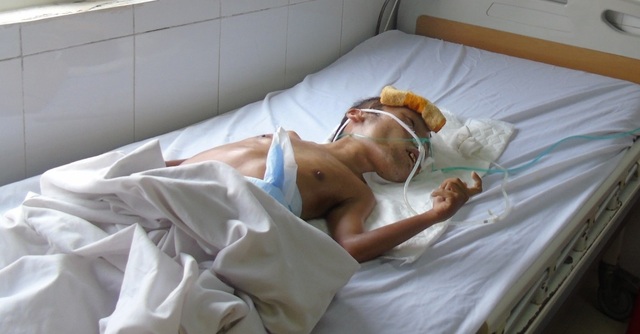 Sự sống mong manh của người đàn ông tàn tật 40 tuổi nặng 5kg - 1 Bị nhiễm chất độc màu da cam nên 41 năm qua anh Cường không một ngày có thể đi lại được. Thân hình anh cũng chỉ như đứa trẻ với cân nặng chỉ 5 kg.