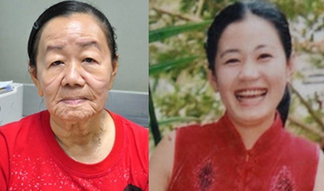 Chị Nguyễn Thị Phượng ở Bến Tre trước và sau khi mắc căn bệnh lão hóa hiếm gặp.