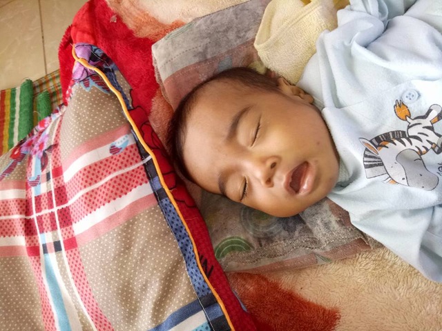 Nhói lòng bé 10 tháng tuổi bị teo mật bẩm sinh - 2 Cháu Khôi bị teo ống mật và bộ phận sinh dục to lên rất đau đớn.
