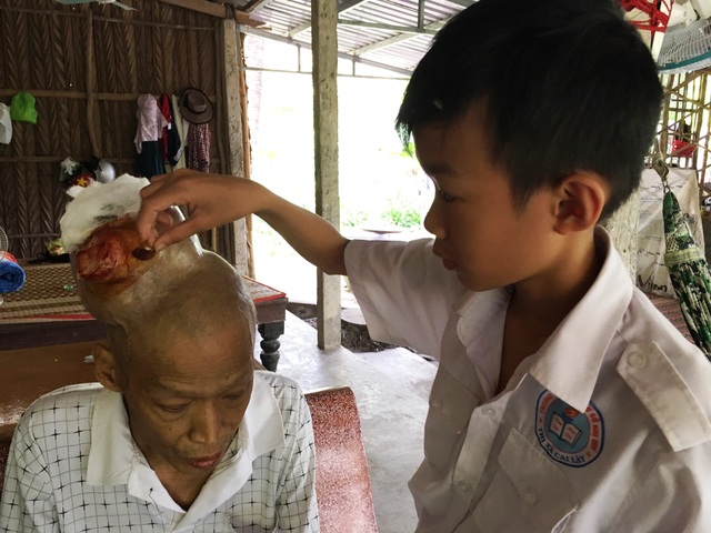 Thương bé lớp 7 chăm cả cha và mẹ đều mắc bệnh ung thư - 1 Mỗi ngày khi đi học về Quang thường chăm sóc vết thương cho cha