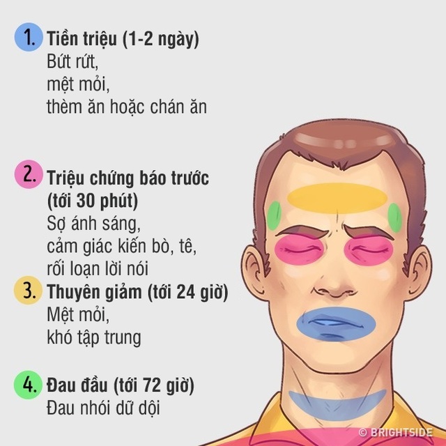 Làm thế nào để ngăn ngừa đau đầu vùng 2 lông mày?
