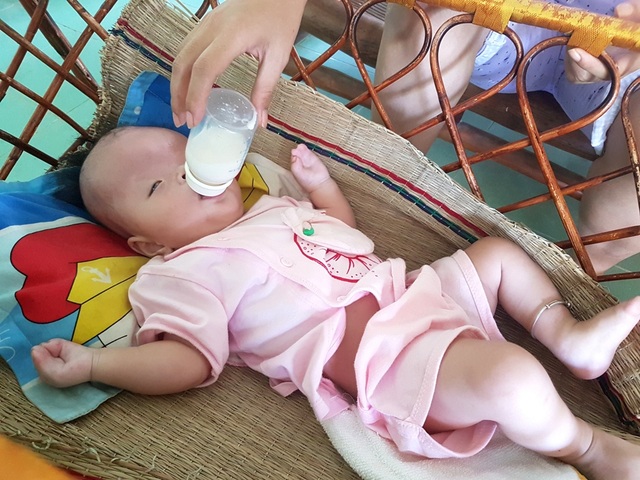 Thương bé 7 tháng tuổi mắc hội chứng Apert hiếm gặp - 4 Do bị hở hàm ếch nên cháu Na chỉ bú được sữa ngoài