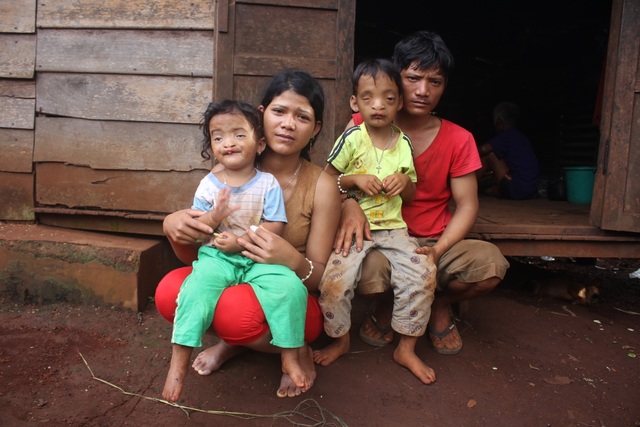 Đáng thương 2 anh em cùng mắc bệnh "suy tim, khiếm thị, hở hàm ếch" - 1 Đôi vợ chồng trẻ “gồng mình” nuôi 2 đứa con tật nguyền