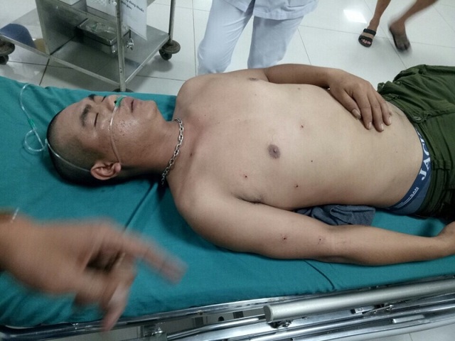 Công nhân trại chăn nuôi bị kẻ lạ mặt bắn trọng thương - 1 Anh Tiến bị thương phải đi cấp cứu tại Bệnh viện Hữu nghị Việt Nam - Cu Ba Đồng Hới. (Ảnh C.H)