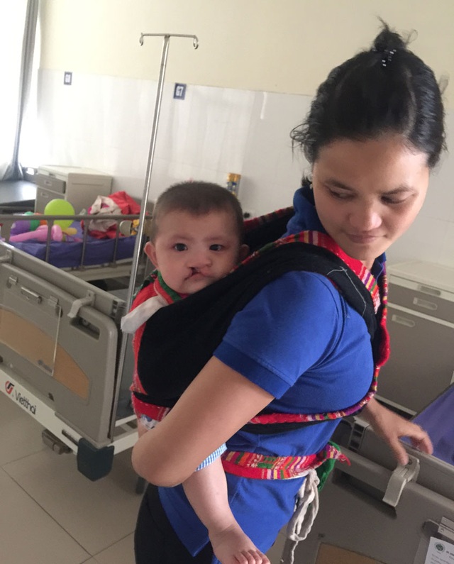 Phẫu thuật miễn phí hở môi, vòm miệng suốt 365 ngày - 2 Bé N.Q (7 tháng tuổi) khi nhập viện nặng 7 kg