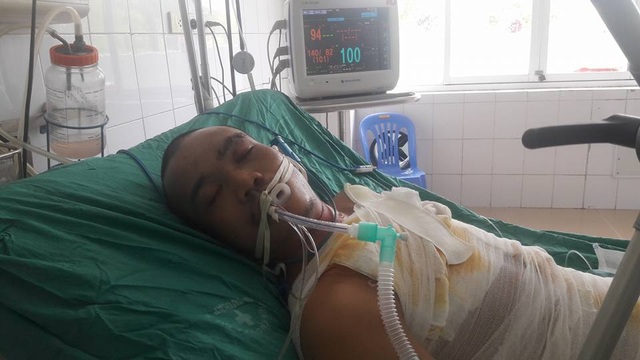 Bị mất 2 tay vì điện cao thế phóng trúng người khi hàn tôn - 4
Nỗi đau khó nói thành lời khi đang khỏe mạnh bỗng dưng thành người tàn phế