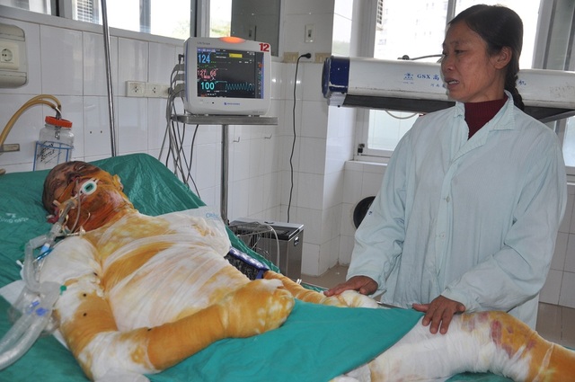 Vợ nghèo đau đớn cùng lúc nhận tin chồng ung thư, con bị bỏng nặng - 6 Không xoay đâu ra tiền để chữa cho con, chị Oanh sợ sẽ mất con mãi mãi.