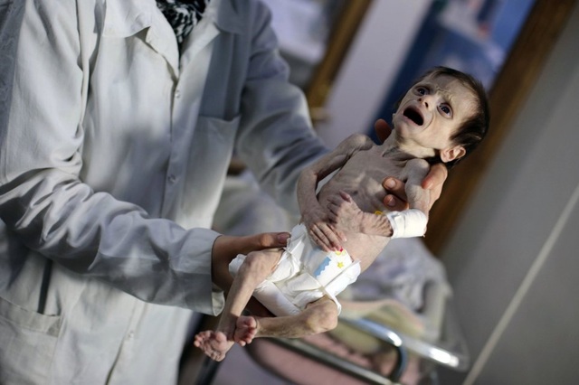 Những hình ảnh về em bé Syria sẽ khiến bạn đầy cảm xúc trước sự tàn ác của cuộc chiến. Xem các em bé vô tội này và hiểu rõ hơn về thực trạng đáng thương của các gia đình Syria.